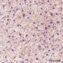 Anti-PSMD9 Mouse mAb