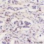 Anti-FABP5 Mouse mAb