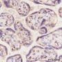 Anti-FABP5 Mouse mAb