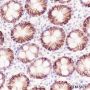 Anti-EpCAM Rabbit mAb