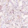 Anti-EpCAM Rabbit mAb