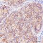 Anti-EpCAM Rabbit mAb