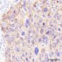 Anti-Keratin 5 Rabbit mAb