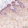 Anti-Keratin 5 Rabbit mAb