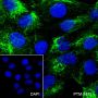 Anti-Keratin 5 Rabbit mAb
