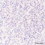 Anti-SOX11 Rabbit mAb