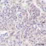 Anti-PRMT5 Rabbit mAb