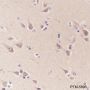 Anti-MAP1LC3A Rabbit mAb