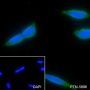 Anti-MAP1LC3A Rabbit mAb