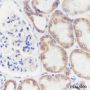 Anti-NDUFB8 Mouse mAb