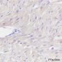 Anti-NDUFB8 Mouse mAb