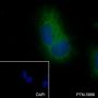 Anti-NDUFB8 Mouse mAb