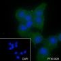 Anti-Integrin alpha V / CD51 Mouse mAb