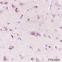 Anti-WWOX Rabbit mAb