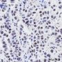 Anti-LSD1 Mouse mAb