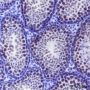 Anti-LSD1 Mouse mAb