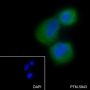 Anti-Keratin 14 Mouse mAb