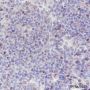 Anti-Aurora B Rabbit mAb