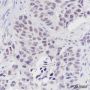 Anti-LSD1 Mouse mAb