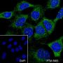 Anti-MEK4/MKK4 Mouse mAb