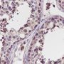 Anti-Smac/Diablo Rabbit mAb