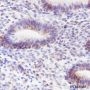 Anti-ALOX15 Rabbit mAb