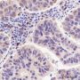 Anti-NUP155 Mouse mAb
