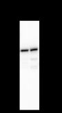 Anti-LPCAT1 Mouse mAb