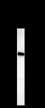 Anti-LPCAT1 Mouse mAb