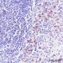 Anti-Cyclin D1 Rabbit mAb