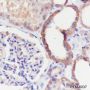 Anti-GOT2 Rabbit mAb
