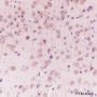 Anti-SIRT2 Mouse mAb