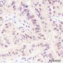 Anti-SUMO-1 Rabbit mAb (C-terminal)