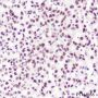 Anti-SUMO-1 Rabbit mAb (C-terminal)