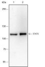 Anti-STAT6 Rabbit mAb