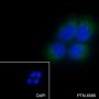 Anti-MESDC2 Mouse mAb