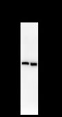 Anti-Sorbitol Dehydrogenase Mouse mAb