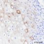 Anti-Keratin 4 Rabbit mAb