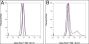 Anti-RANKL Mouse mAb