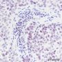 Anti-ING5 Rabbit mAb