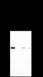 Anti-PD-L1 Rabbit mAb