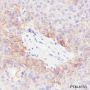 Anti-PD-L1 Rabbit mAb