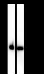 Anti-Serum Amyloid P / SAP Rabbit mAb