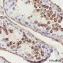 Anti-Serum Amyloid P / SAP Rabbit mAb