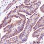 Anti-GOSR1/GS28 Rabbit mAb