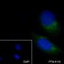 Anti-GOSR1/GS28 Rabbit mAb