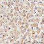 Anti-PHB1 Rabbit mAb