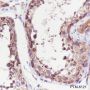 Anti-LysRS Rabbit mAb