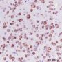 Anti-LysRS Rabbit mAb