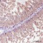 Anti-LysRS Rabbit mAb